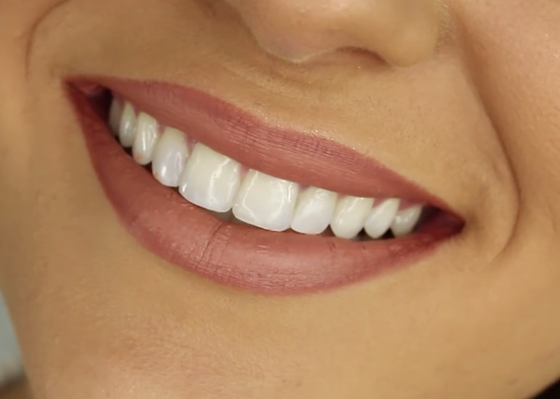 
				Can Teeth Whitening Damage My Teeth?		